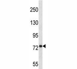 Amyloid beta Precusor Protein Antibody (APP)