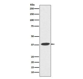 DNA Polymerase beta Antibody / POLB