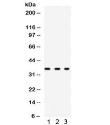 SPARC Antibody