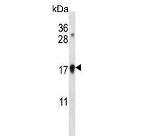 Western blot testing of human Jurkat cell lysate with CDKN1A antibody. Expected molecular weight: 18
