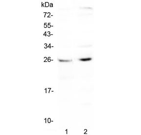 CTR1 Antibody / Copper transporter 1