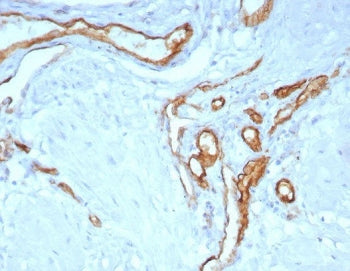 IHC staining of FFPE human uterus tissue with CD31 antibody (clone C31/8243R). HIER: boil tissue sec