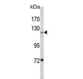 Western blot testing of human T47-D cell lysate with Focal Adhesion Kinase antibody. Predicted molec