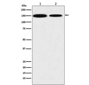 KDM4A Antibody / JMJD2A