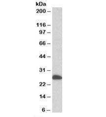 ETFB Antibody
