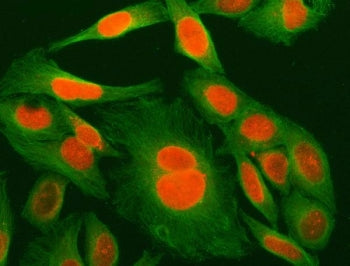 MED29 Antibody / Mediator of RNA polymerase II transcription subunit 29