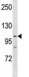 PARP 1 Antibody