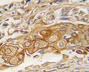 ACPP Antibody / PAP / Prostatic acid phosphatase