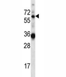 GATAD2B antibody western blot analysis in mouse heart tissue lysate