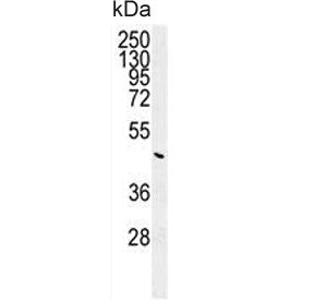 G6PC Antibody