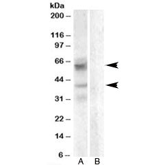 Western blot testing of A459 lysate with Arylsulfatase D antibody with [B] and without [A] blocking/
