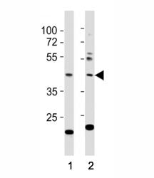 E2F1 Antibody