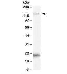 Western blot testing of Daudi cell lysate with HTATSF1 antibody at 1ug/ml. Rountinely observed at 13