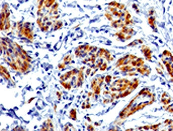 Caldesmon / CAD Antibody HMW