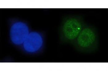 Immunofluorescent staining of FFPE human A549 cells with EAP2 antibody (green) and DAPI nuclear stai