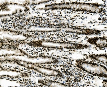 Vinexin Antibody / SORBS3