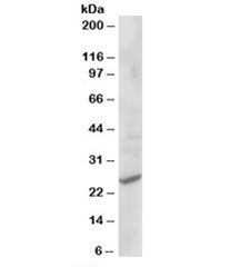 CYB561D2 Antibody