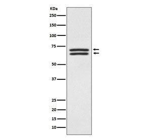 PDPK1 Antibody / 3-phosphoinositide-dependent protein kinase 1