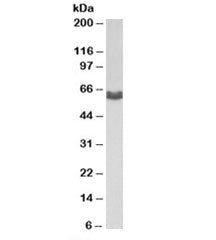 Western blot testing of human MDA-MB-231 cell lysate with AMHR2 antibody at 1ug/ml. Predicted molecu