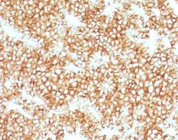 Parathyroid Hormone Antibody / N Terminal