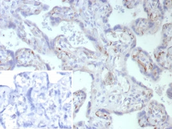 FABP4 Antibody