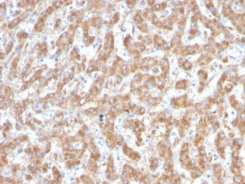 C1QA Antibody / Complement C1q A-Chain