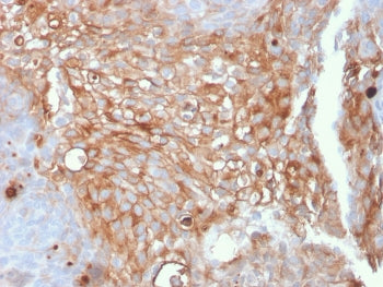 Uroplakin 1A Antibody / UPK1A