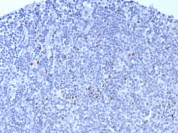 FOXP3 Antibody / Scurfin