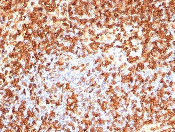 IHC staining of FFPE human spleen tissue with CD74 antibody (clone CLIP/7192) at 2ug/ml. HIER: boil 