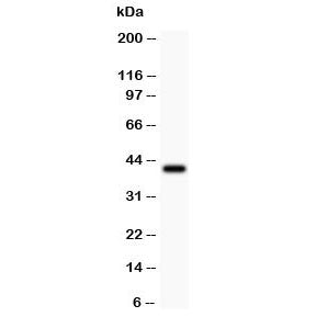 Collagen IV Antibody / COL4A1