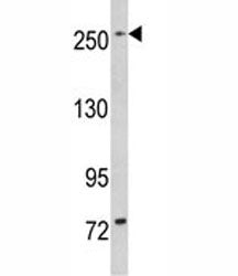 LRRK1 Antibody