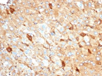 IHC staining of FFPE human liver tissue with recombinant ALB antibody (clone rALB/6410). HIER: boil 