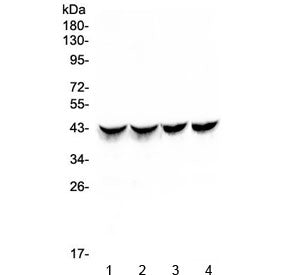 CTnT Antibody / Cardiac Troponin T / TNNT2