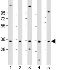 PIGC Antibody