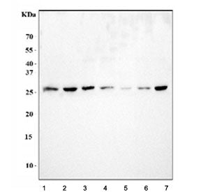 Western blot testing of human 1) HeLa, 2) SiHa, 3) U-87 MG, 4) RT4, 5) HaCaT, 6) PC-3 and 7) T-47D c