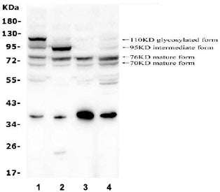 GAA Antibody / Glucosidase alpha acid
