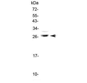 MPZ Antibody / Myelin Protein Zero