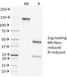 SDS-PAGE Analysis of Purified, BSA-Free Clathrin Heavy Chain Antibody (clone CLTC/1431). Confirmatio