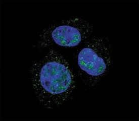 Retinoblastoma / Rb Antibody (phospho-S811)