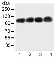 CEA Antibody