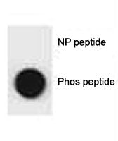 p62 Antibody SQSTM1 (phospho-S207)