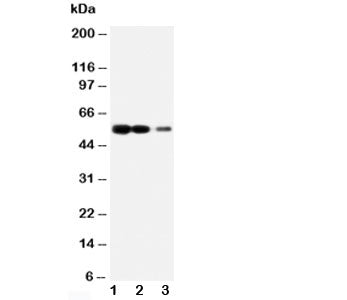 Western blot testing of RAGE antibody and Lane 1: recombinant human protein 10ng; 2: 5ng; 3: 2.5ng