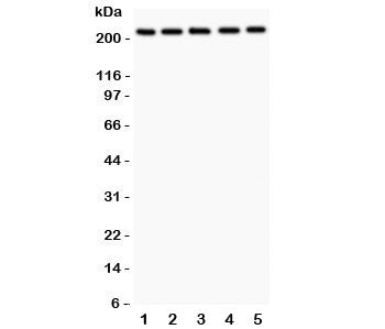 TSC2 Antibody
