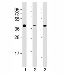 Western blot testing of ERCC1 antibody at 1:2000 dilution. Lane 1: A549 lysate; 2: HeLa lysate; 3: T