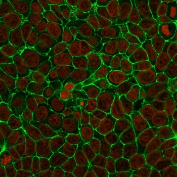 Immunofluorescent staining of human MCF7 cells with anti-EpCAM antibody (clone SPM134, green) and Re