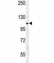 AARS2 Antibody