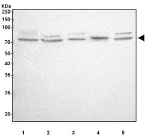 Western blot testing of 1) human A549, 2) human MCF7, 3) human Jurkat, 4) rat RH35 and 5) mouse RAW264.7 cell lysate with ALOX12 antibody. Predicted molecular weight ~76 kDa.