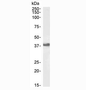 Western blot testing of human Daudi lysate with CD32 antibody at 1ug/ml. Predicted molecular weight: