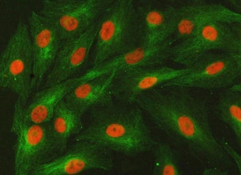Immunofluorescent staining of FFPE human A549 cells with SNF2L2 antibody (red) and Beta Tubulin mAb 