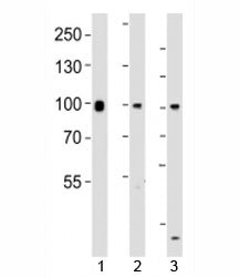Western blot testing of Suz12 antibody at 1:1000 dilution. Lane 1: mouse F9 lysate; 2: human HeLa ly